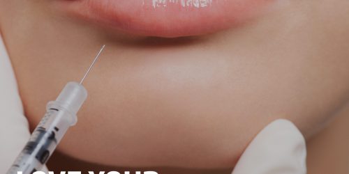 Love Your Lips with Filler Blog
